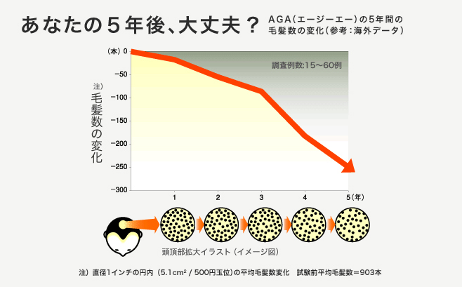 AGAの5年間の毛髪数の変化